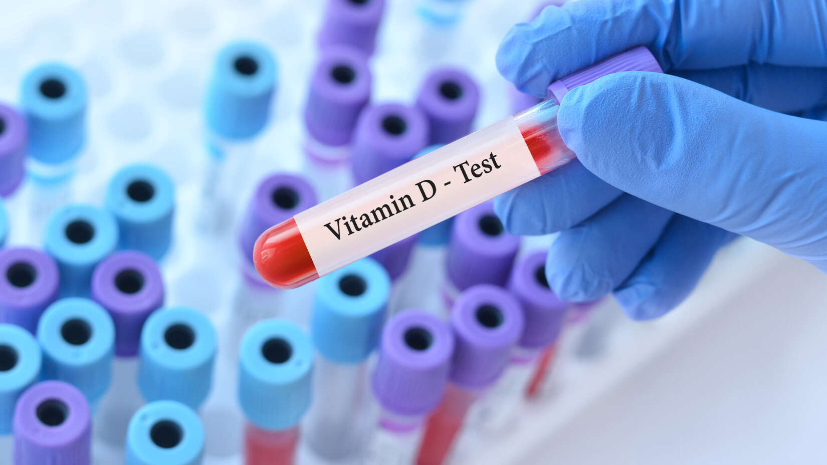 Vit D Bedarf